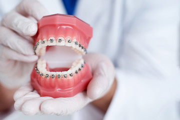 How Braces Can Improve Your Oral Health